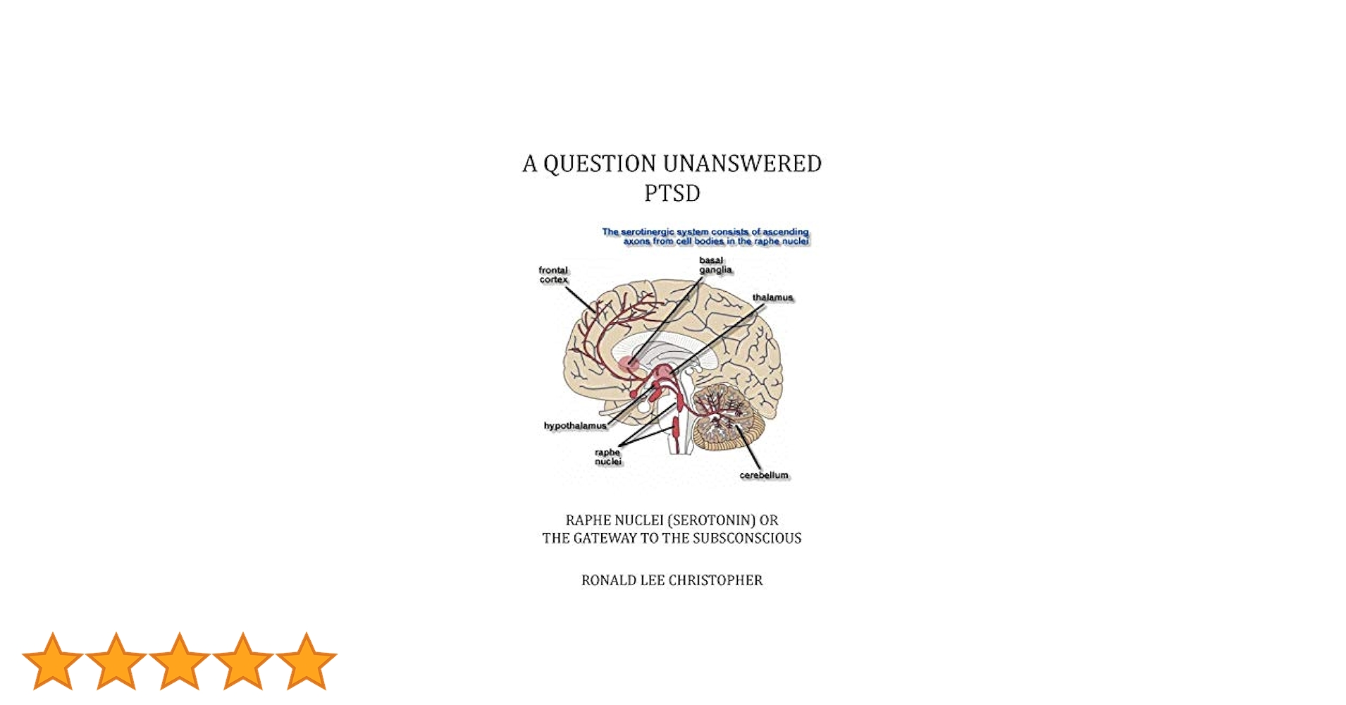 Amazon.co.jp: A Question Unanswered PTSD: Raphe Nuclei