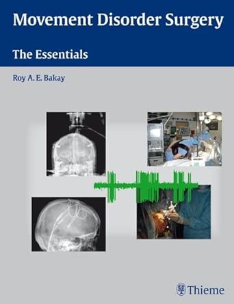 Movement Disorder Surgery: The Essentials book cover