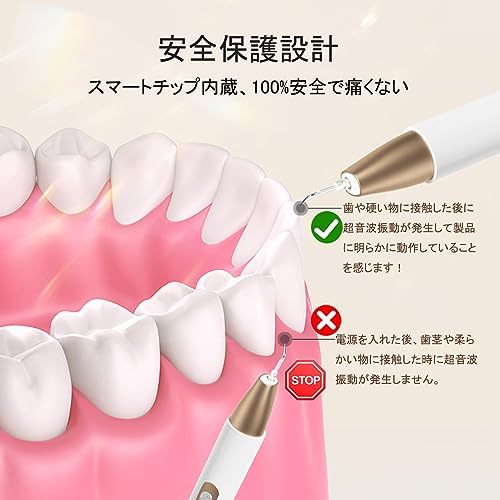 Micfendy 超音波歯クリーナー 歯間クリーナー 口腔洗浄器 USB 充電式 携帯用歯清潔器 5モード調節可能 LEDライト クリーニングキット の商品画像 3