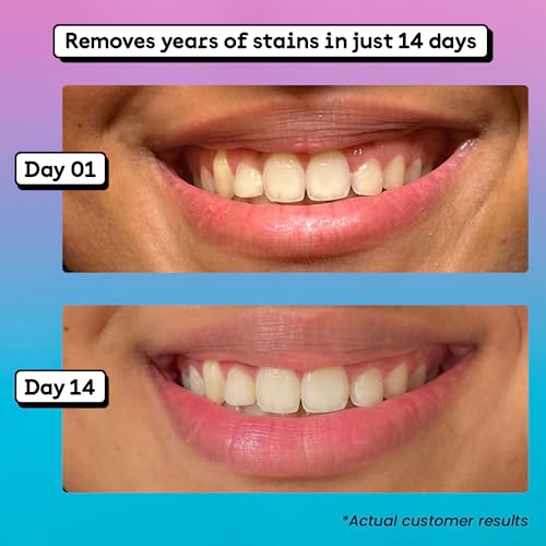 Image of Daybreak Teeth Whitening Powder 30g with PAP + HAp | At-Home Whitening Treatment | See Results in 7 Days | Helps Remove Years of Stains | Peroxide & Cruelty Free | 100% Enamel Safe | Pack of 1