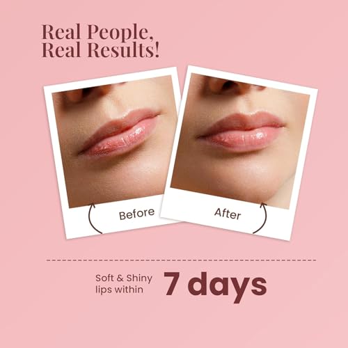 Image of Beetroot Lip Balm Spf 20 with Beetroot for Moisture Hydrates & Lighten Dark Lips Beetroot (Pack of: 1, 10 g)