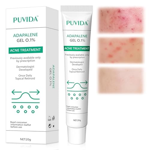 20g Crema Brufoli Viso,Crema per acne,Crema Per Pelli Grasse a Tendenza Acneica,Riduce Imperfezioni e Sebo,Per la maggior parte dei tipi di pelle,Uomini e donne