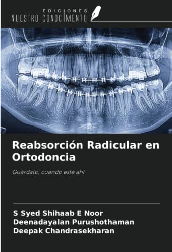 Reabsorción Radicular en Ortodoncia: Guárdalo, cuando esté ahí