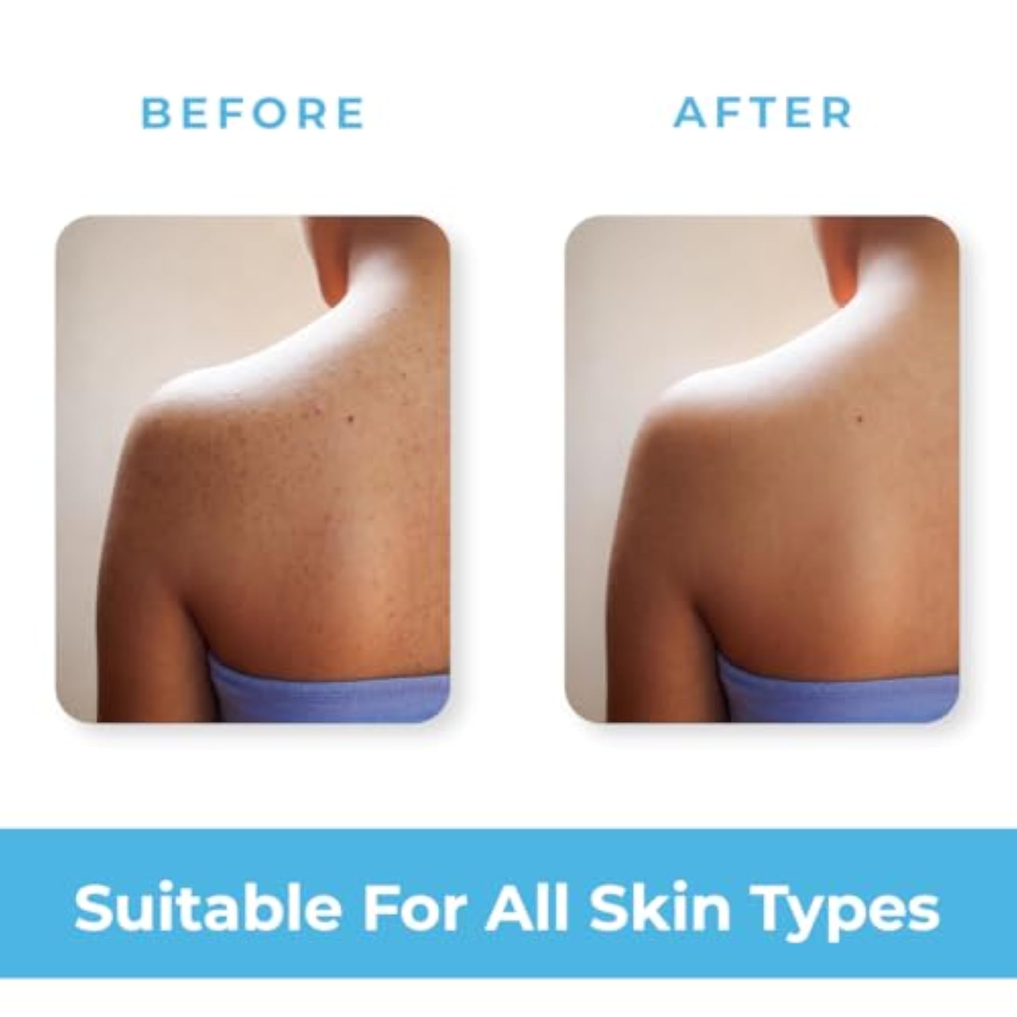 WOW Skin Science Moisturising Soaps with Ceramide, Pack of 4