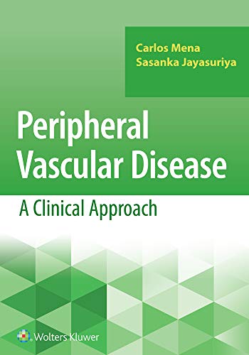 Peripheral Vascular Disease: A Clinical Approach (English Edition)