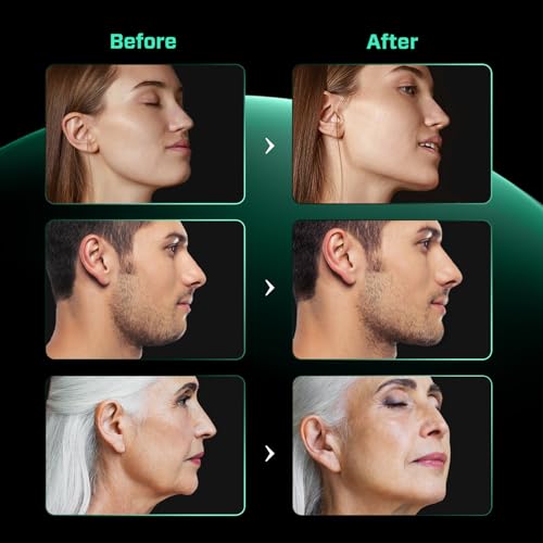 SELENCIO Jaw Exerciser 4-Pack Set