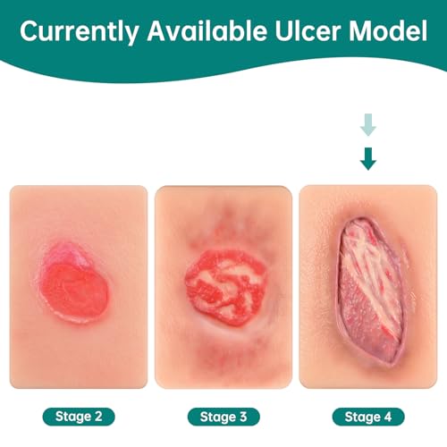 Image of Pressure Ulcer Wound Model Stage 4 Pocket Size, Wound Packing Trainer for Medical Education, Wound Care Demonstrations Tool