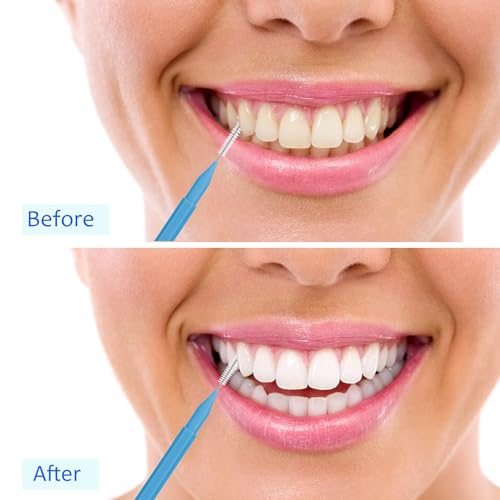 Image of Patelai 100 Pieces Braces Dental Brush for Cleaner Interdental Toothpick Dental Tooth Flossing Head Oral Hygiene Flosser Toothpick Cleaners Tooth Tool(Blue, Grey,Mixed Sizes)