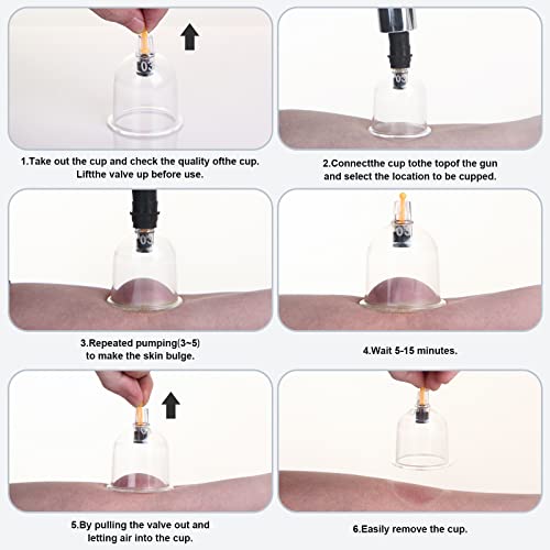 Svnteak Cupping Set, Cupping Therapy Sets 20 Cups With Pump Suction Cupping Kit For Body Cellulite Muscle Back Massage, Pain Relief, Physical Therapy, Chinese Cupping Kit #TOP2