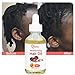 Natural Baby Kids Hair Care Products - Extra Strength Growing & Nourishing Serum with Black Seed Oil for Powerful Thick, Full Hair Growth