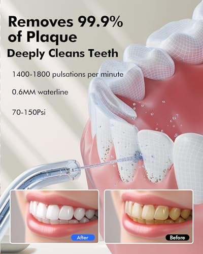 Munddusche Kabellos Water Flosser Zahnreinigung : LED-Anzeige 5 Modi Zahndusche mit 300ML Wassertank & 6 Düsen, IPX7 Wasserdichte Oral Irrigator Munddusche Testsieger(Schwarz) – Bild 3