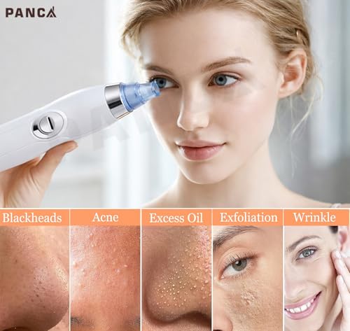 Image of PANCA Blackhead Remover Vacuum for Face | 4 in 1 Pore Cleaner Suction Device with Multiple Heads | Facial Cleansing Tool for Blackhead Whitehead Removal for Men & Women