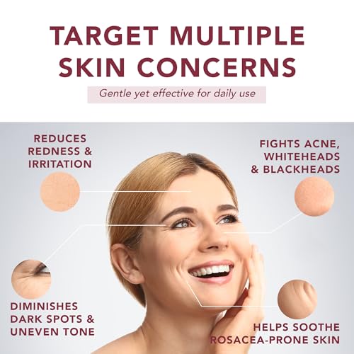 Suquato Azelainsäure Serum 10% – Azelaic Acid Gesichtspflege gegen Rosacea, Rötungen & Akne – Mit Niacinamid & Hyaluronsäure (30ml)