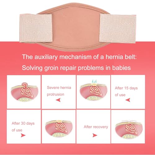 Faja para Hernia Umbilical en Bebés Ajustable y Suave Small miniatura 2