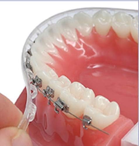 Clip-On Comfort Lip-Shield/Mouth Guard - for Braces - Better Than Dental Wax - Orthodontic - Dental … (Single Pack)