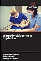 Wzgledy okluzyjne w implantach (Polish Edition) 6208700019 Book Cover