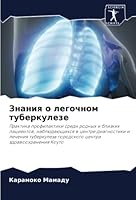 Знания о легочном туберк 6204372696 Book Cover