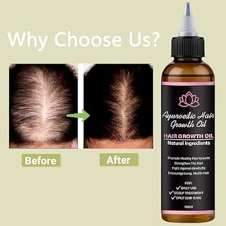 Lifewitqueenp Hair Care Growth Oil, Queenp Ayurvedic Hair Growth Oil, Lightweight for All Hair Types (1pcs)