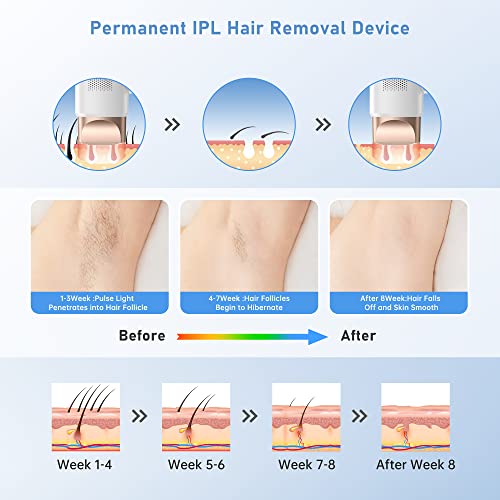 Aopvui Laser Hair Removal For Women And Men, Ipl Permanent Hair Removal 999900 Flashes Hair Remover Device For Whole Body Use #TOP4