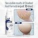 FOOTLOGIX Cracked Heel Formula, White 4.23 Ounce