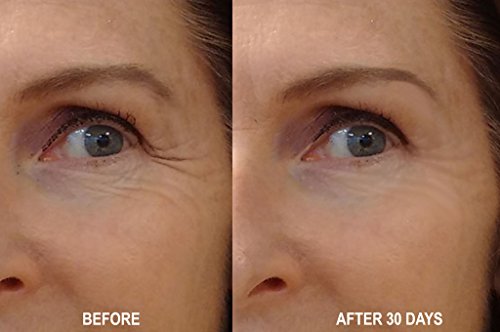 Dna Code®-No Needle Alternative-Pure Argireline Peptides Wrinkle Reduce Serum+ Matrixyl 3000+Hyaluronic Acid #TOP2