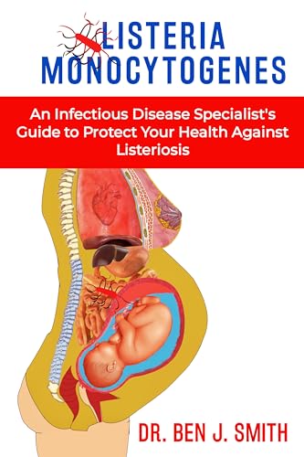 LISTERIA MONOCYTOGENES: An Infectious Disease Specialist’s Guide to Protect Your Health Against Listeriosis (English Edition) - Smith, Dr. Ben J. 