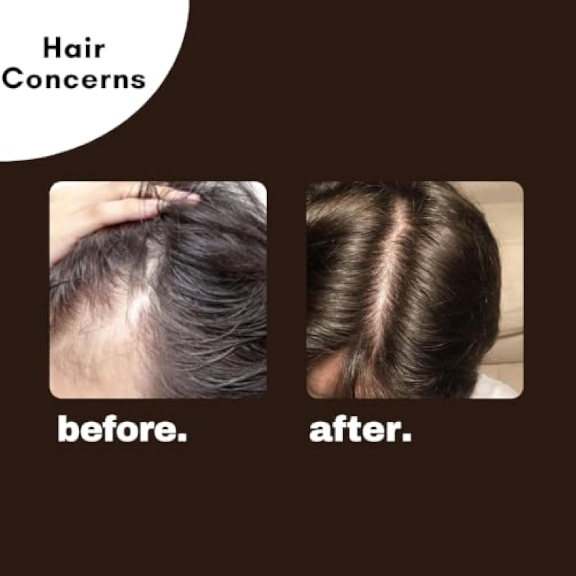 Fallcure Hair Oil Pack of 2 for Stronger Roots
