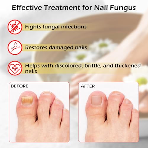 Toe Nail Fungus Treatments for Toenail: Nail Fungus Treatment for Fingernails – Extra Strength, Fast-Acting Solution for Cracked, Damaged, Discolored Nails