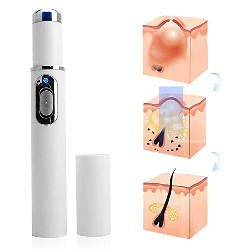 MZNTBW Krampfadern Entfernungsstift Akne Entferner Gerät, Blaulicht-Therapiestift für Besenreiser, Akne-Laser-Stift Tragbare Mini Straffung Gesicht Hautpflege-Tool Cover