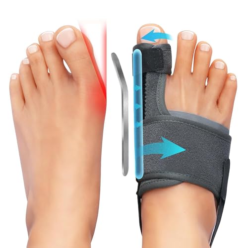 XFSRG 1 par corrector Hallux Valgus para mujer Separador Dedo con almohadillas protectoras Orthese Hallux Valgus Corrective Ajustables Rectificador Dedo Adecuado Hombre Y Mujer (Gris)