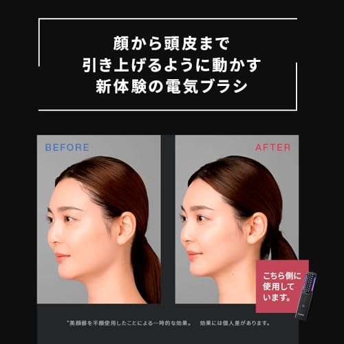 Brighte ELEKI BRUSH（旧型） & LOTION & スカルプブラシ の商品画像 2