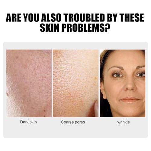 Generic Aobenz Spot Remover Serum For Face, Aobenz Remover Freckle Essence, Melasma Freckle, Sun Spot, Age Spot, Brown Spot, Spot Corrector Facial Serum For All Skin Types Spot For Men And Women thumb #2