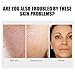Generic Aobenz Spot Remover Serum for Face, Aobenz Remover Freckle Essence, Melasma Freckle, Sun Spot, Age Spot, Brown Spot, Spot Corrector Facial Serum for All Skin Types Spot for Men and Women