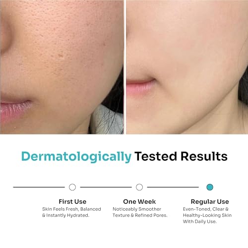 Image of Kitcoz 5% Niacinamide and 8% Glycolic Acid Face Toner with Rice Water 150ml | Alcohol Free with Sake Ferment, Licorice and Aloe. For pores, texture and hydration. All skin types, AM and PM.