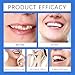 Silicone Reline Denture Set,Silicone Dentures Set,Silicone Soft Dentures Repair, Denture Repair Kit, Soft Denture Reline Kit for Men and Women(2PCS)