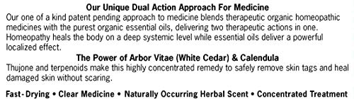 Forces Of Nature -Natural, organic skin Tag Extra Strength Remover (4ml) Non Gmo, No Harmful Chemicals -Safe, Pain & Scar Free, Leaving Skin Smooth & Healthy - Thumbnail 5
