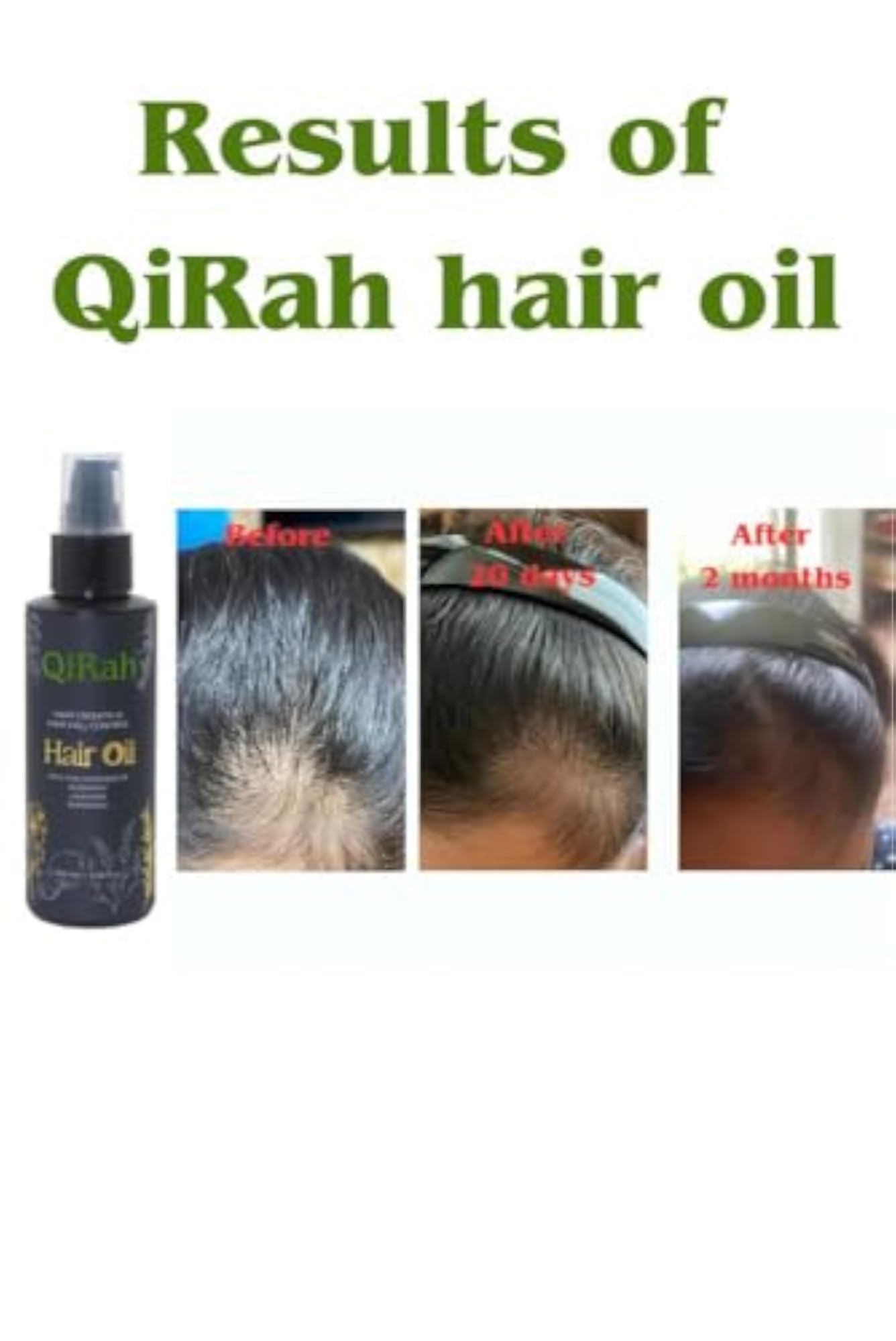 Natural Hair Growth Oil for Men & Women, 100 ml