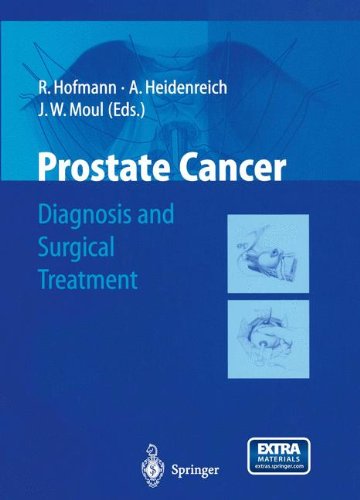 Prostate Cancer