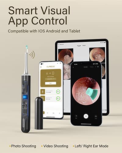 Ear Cleaner Earwax Removal Kit, Ear Cleaning Tool, Ear Wax Remover Ear Cleaner Camera With 1080P Otoscope With Light, Ear Wax Removal Kit With Ear Pick, Ear Camera Compatible For Iphone, Android #TOP4