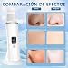 Imagen de ACWOO Peeling Ultrasónico Facial