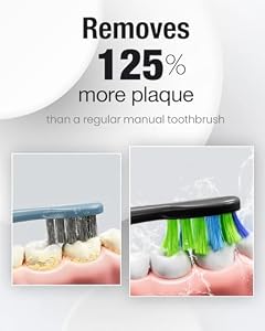 7AM2M Sonic Electric Toothbrush for Adults, Type-C Charging Run for 120 Days — photo 2 of 6