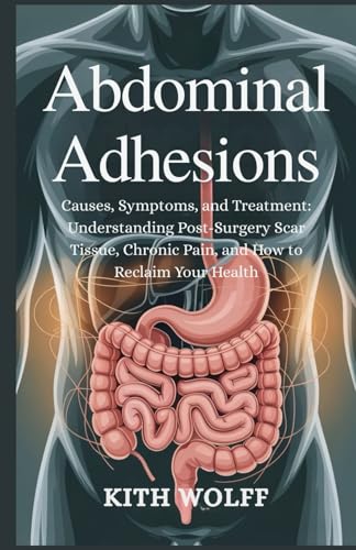 Abdominal Adhesions: Causes, Symptoms, and Treatment: Understanding Post-Surgery Scar Tissue, Chronic Pain, and How to Reclaim Your Health
