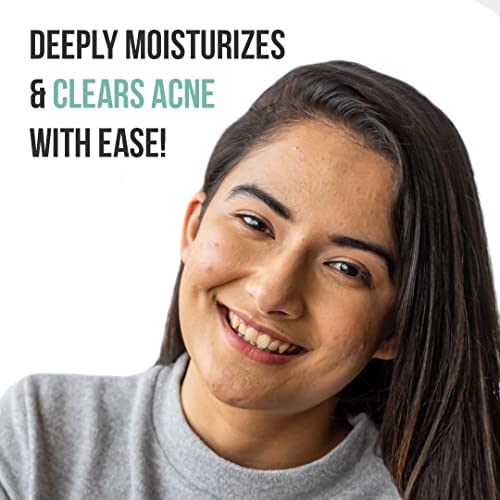 Image of FURR 2% Salicylic Acid & Green Tea Anti Acne Face Moisturizer