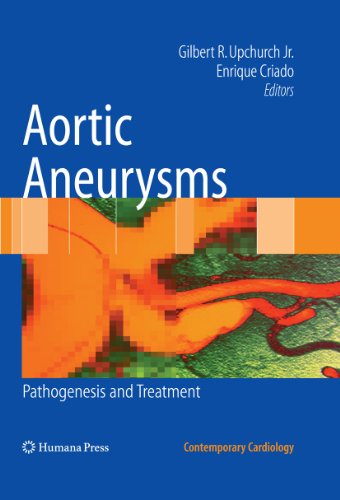 Aortic Aneurysms: Pathogenesis and Treatment (Contemporary Cardiology)