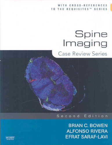 Spine Imaging: Case Review Series