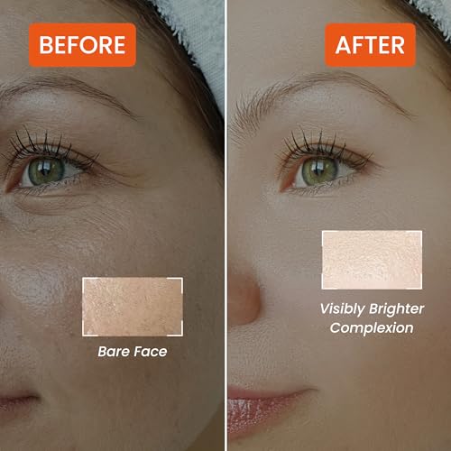 Image of Vitamin C Face Serum with Ascorbic Acid, Lemon & Amla | Brightening Serum for Dark Spots, Pigmentation & Uneven Skin Tone | 30 ml