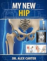 MY NEW HIP: The Complete Guide to Hip Replacement Surgery, Recovery, Rehab, Pain Relief, Exercises, and Regaining Mobility B0GLGLNP8M Book Cover