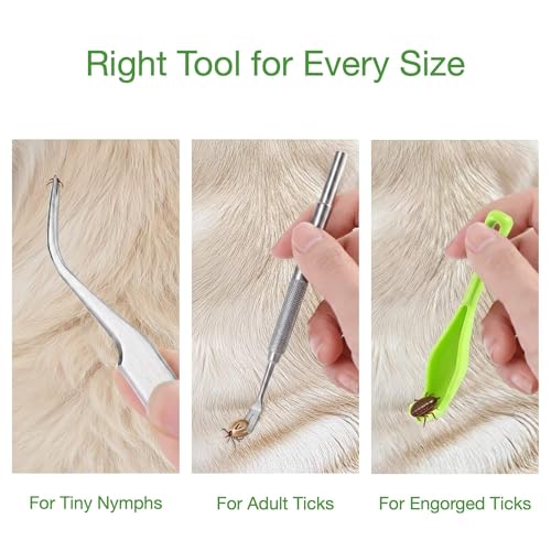 AHHOMATATA 10-in-1 Tick Remover Kit
