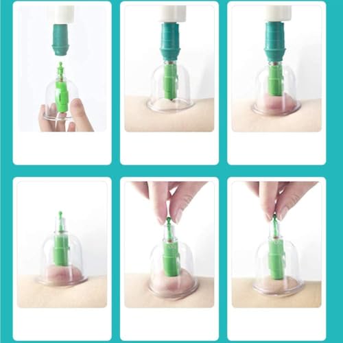 Juego de ventosas al vacío de 12 piezas, kit profesional de masaje TCM para uso en casa, clínica y salón miniatura 3