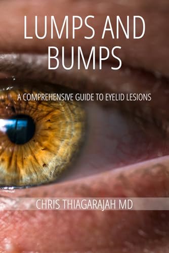 Lumps and Bumps: A Comprehensive Guide to Eyelid Lesions